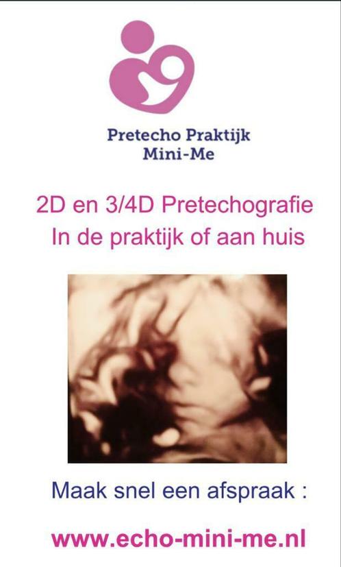 Pretecho’s-2D 3/4D-babyshower-thuisecho-genderreveal-zwanger Pretecho’s-2D 3/4D-babyshower-thuisecho-genderreveal-zwanger