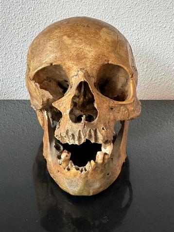 Antieke anatomische mensen schedel skelet medisch 