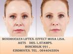 BOTOX. FILLER . Momenteel een langdurend effect Mona Lisa, Geeft ook workshops, Huidbehandeling