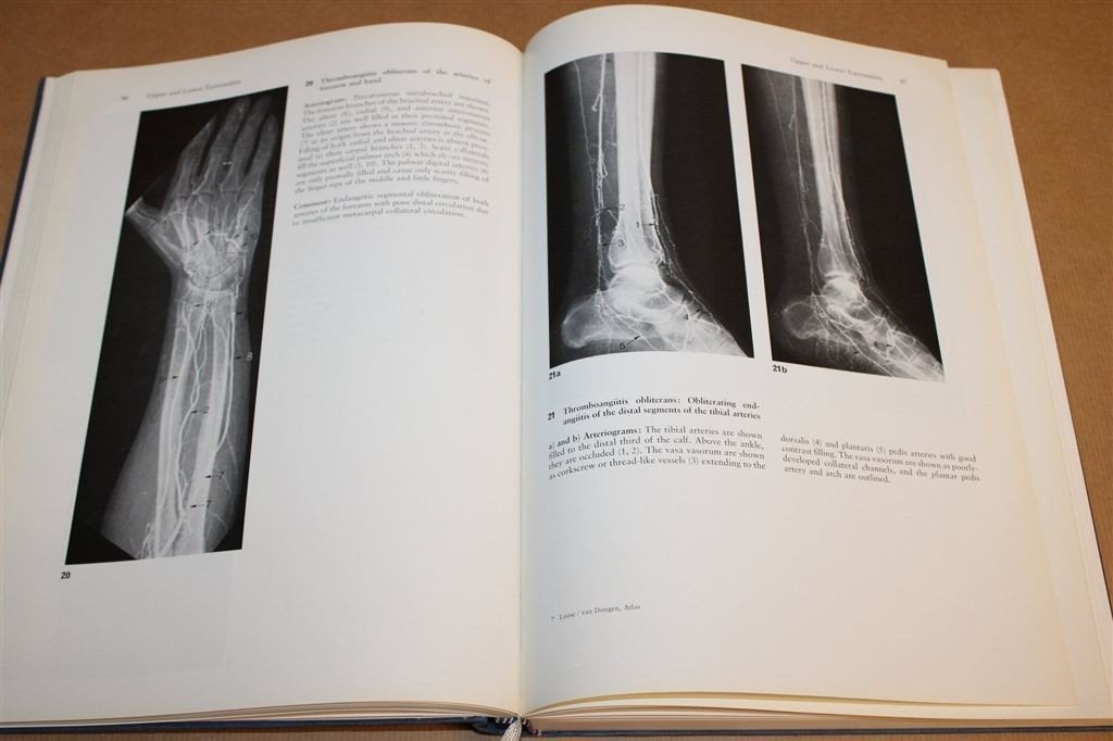 Atlas of Angiography — 707 Illustrations, Thieme 1976, Ophalen of Verzenden, Gelezen, Natuurwetenschap