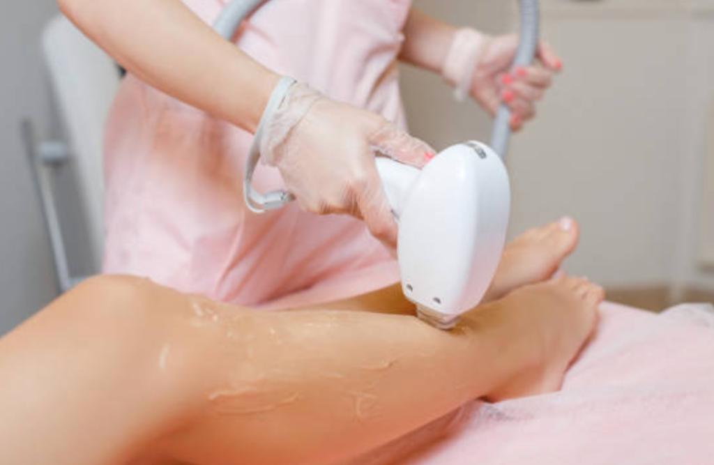 Laserontharing: Gladde huid, langdurig resultaat|20% korting, Huidbehandeling
