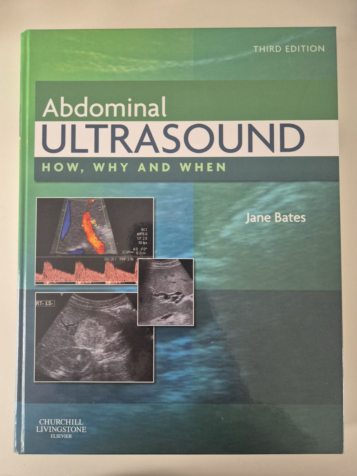 Abdominal Ultrasound how, why and when third edition, Boeken, Ophalen of Verzenden, Beta, Zo goed als nieuw, WO