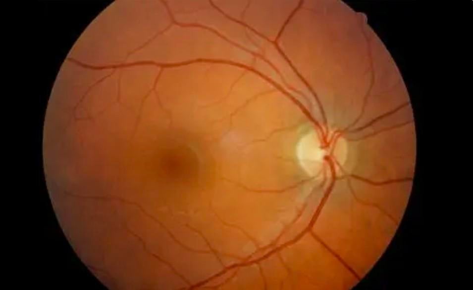 Oog gezondheidsOnderzoek vooraf meer genot van u bril!, Ophalen of Verzenden