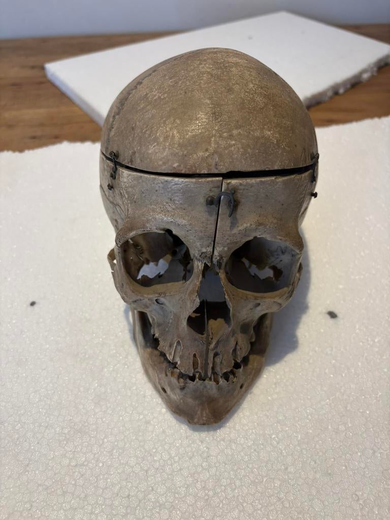 Antieke echte menselijke schedel anatomisch medisch preparaa, Ophalen of Verzenden, Zo goed als nieuw