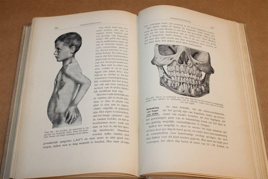 Verpleging In Het Huisgezin [1913] — Antiek Medisch Handboek, Ophalen of Verzenden, Gelezen