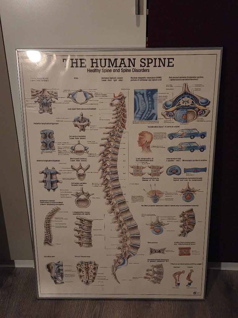 Grote Ingelijste Anatomische Poster (70x100 cm)–Wervelkolom, Ophalen, 70 cm, Papier/karton, Decoratieobject