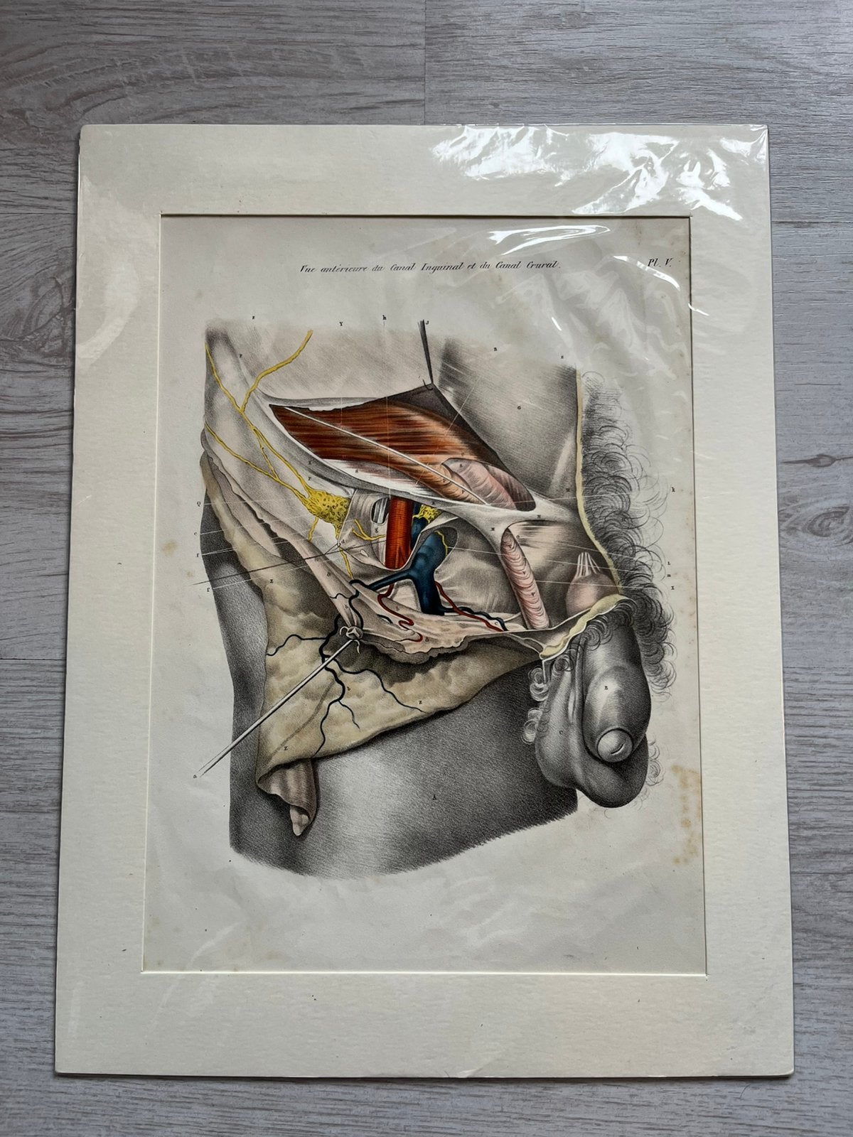Tekening canal inguinal, Ophalen of Verzenden