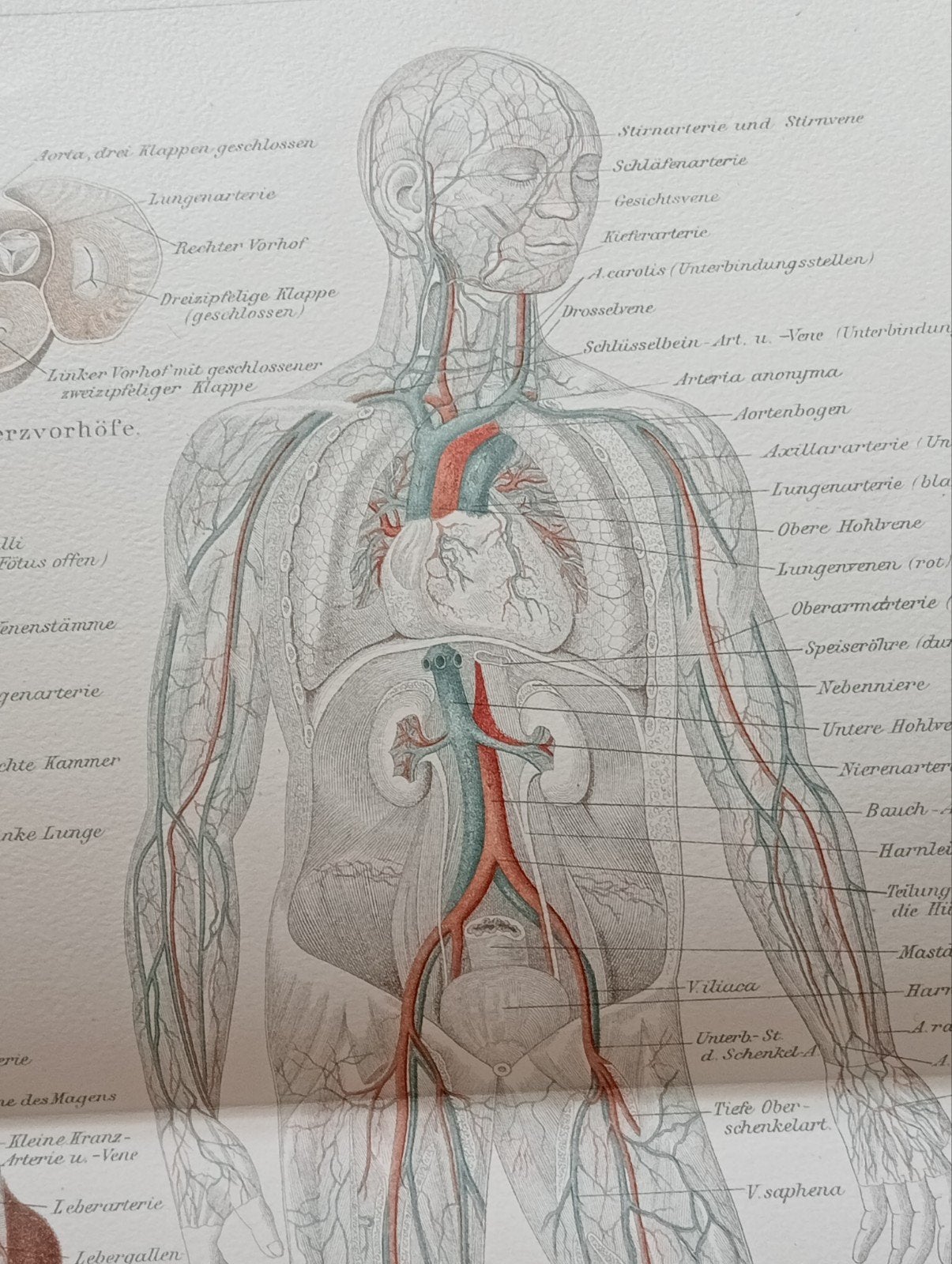 Anatomische Medische Litho 1895 Bloedvaten, Ophalen of Verzenden, Voor 1940, Gebruikt