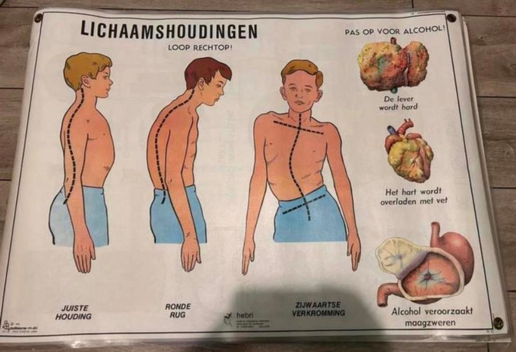 Anatomische posters, Ophalen