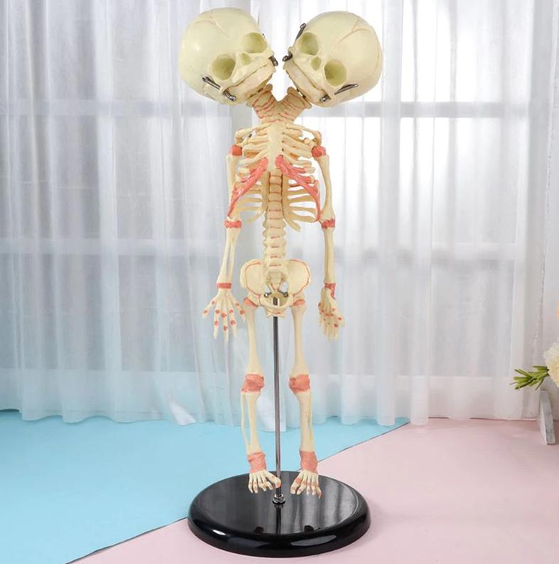 Siamese Tweeling Menselijk Anatomie Model / Skelet Geraamte, Diversen, Schoolbenodigdheden, Verzenden, Nieuw