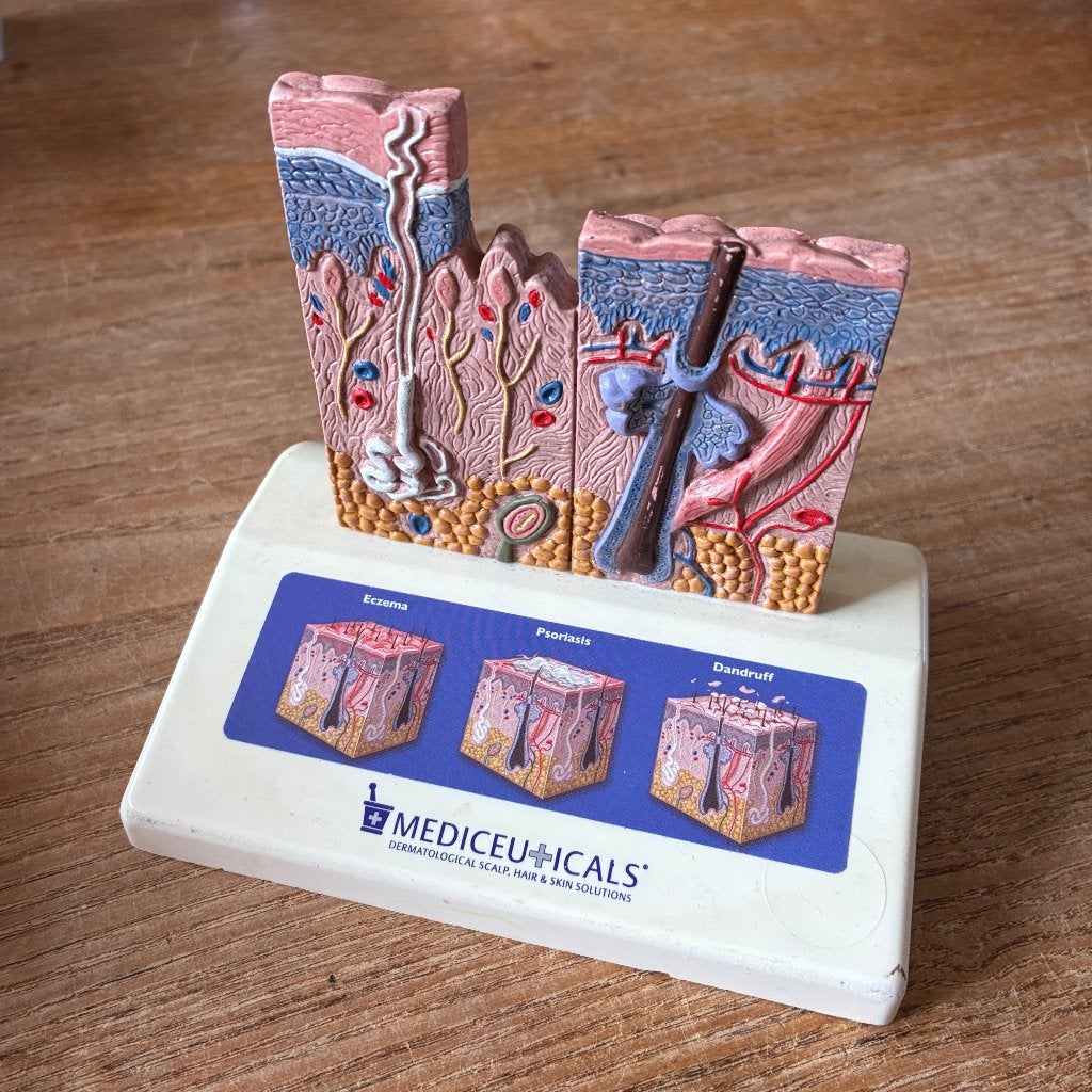 Vintage anatomisch model van de huid (14x10x12,2cm), Ophalen of Verzenden