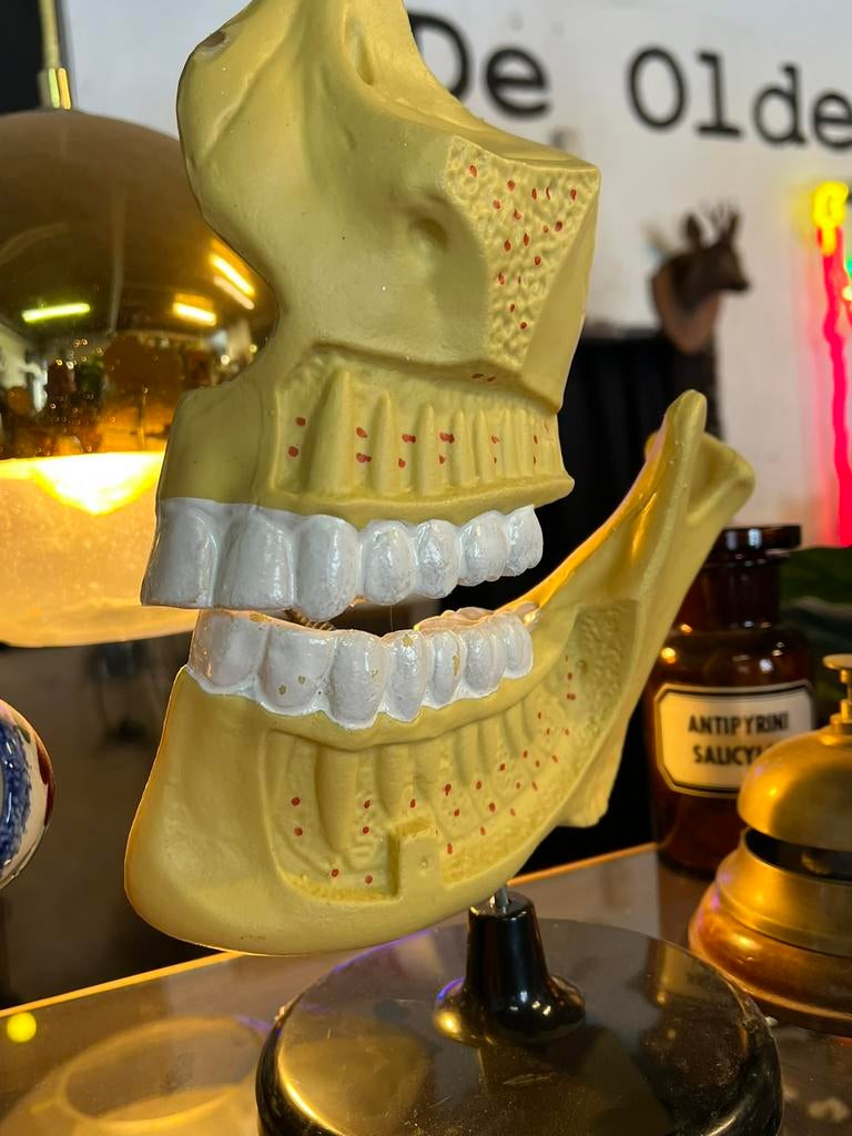 Anatomisch model gebit, Ophalen of Verzenden
