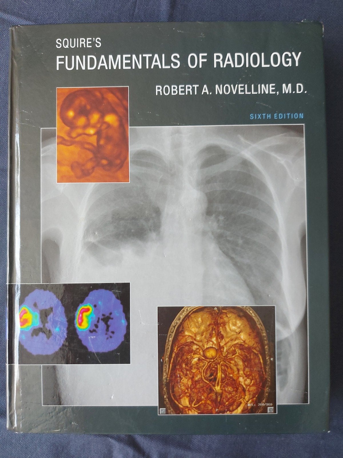 Squire's Fundamentals of Radiology - Zesde Editie, Gelezen, Ophalen of Verzenden, WO, Robert A. Novelline, M.D.