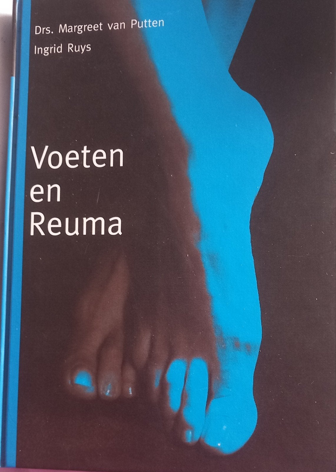 M.A. van Putten - Voeten en reuma, Ophalen of Verzenden, Zo goed als nieuw, M.A. van Putten; I.J.H. Ruys