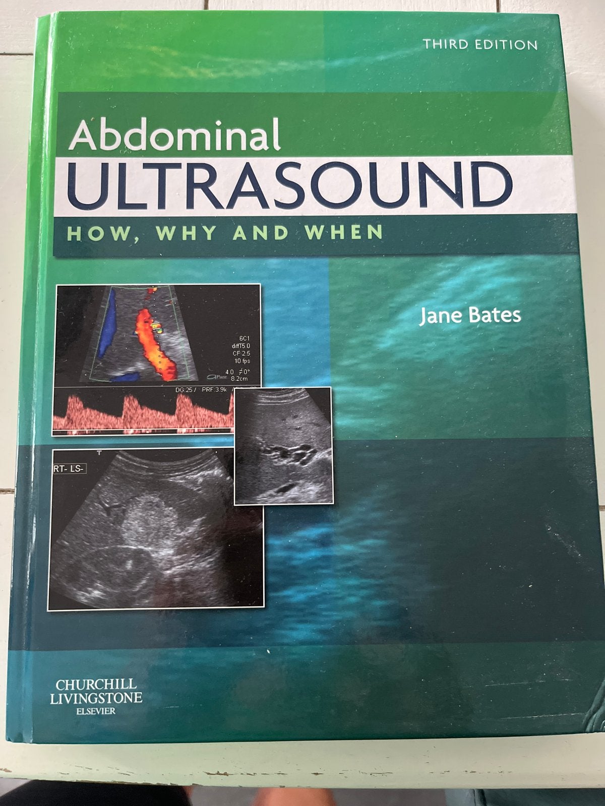 Abdominal Ultrasound: How, Why and When - Jane Bates, Boeken, Ophalen of Verzenden, Beta, Gelezen, HBO