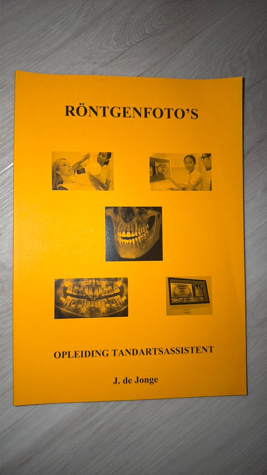 J. de Jonge - Röntgenfoto's, Nieuw, Ophalen of Verzenden, J. de Jonge, Nederlands