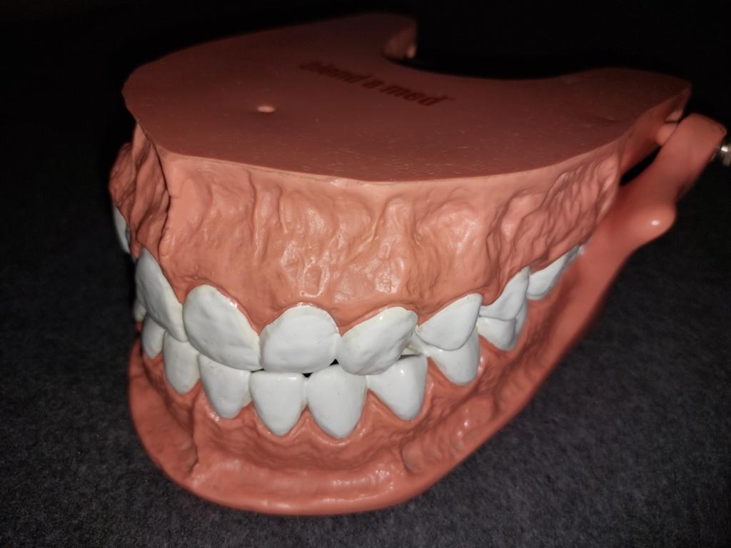 Anatomisch Educatief Model Menselijk Gebit en Gingiva, Antiek en Kunst, Ophalen of Verzenden
