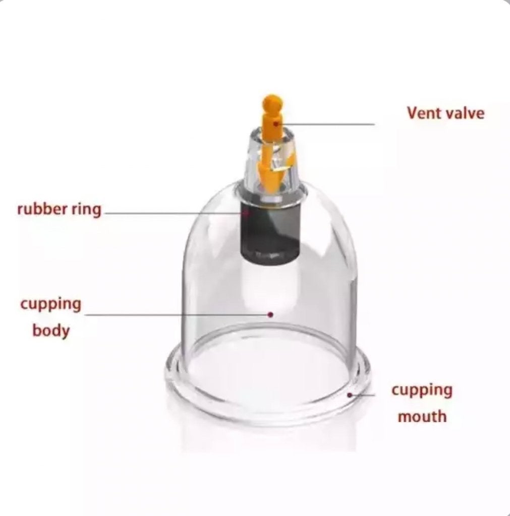 Dry or wet Cupping Cups, Ophalen of Verzenden, Nieuw, Apparaat