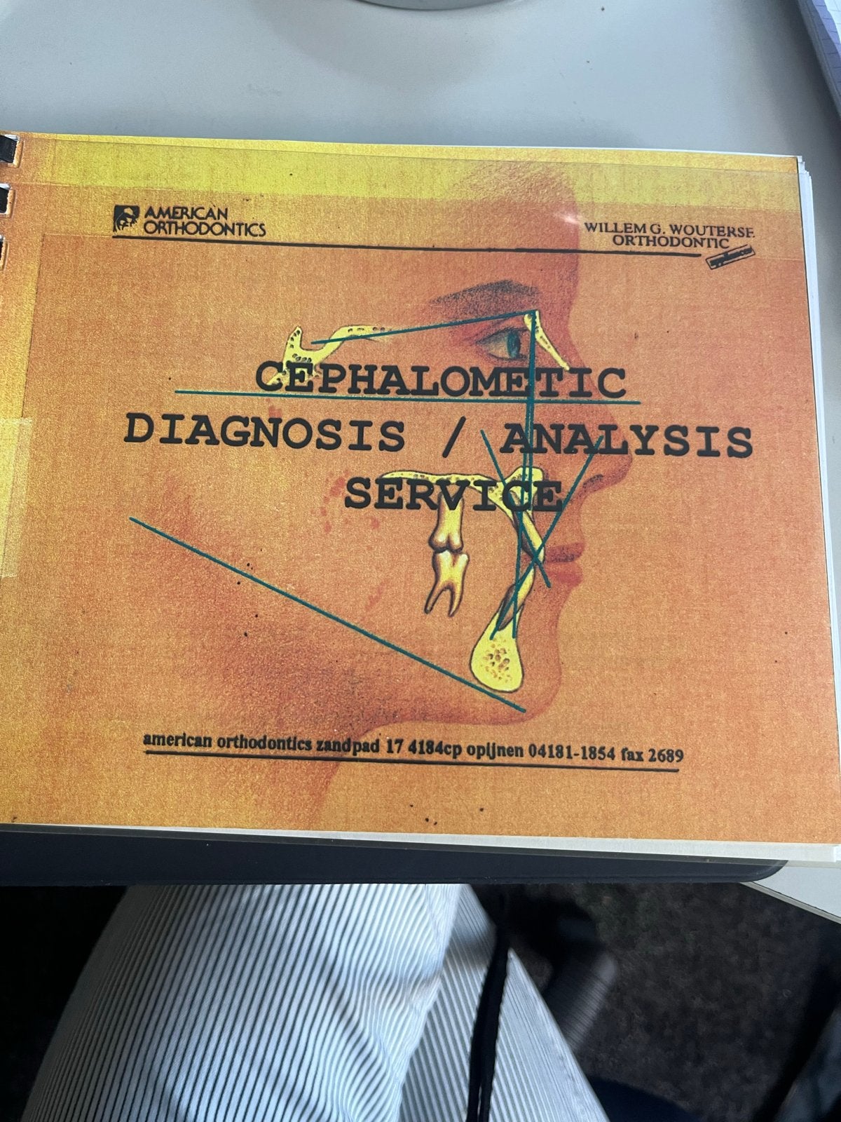 Cephalometric Diagnosis / Analysis Service Boek, Ophalen of Verzenden, Gelezen, Natuurwetenschap