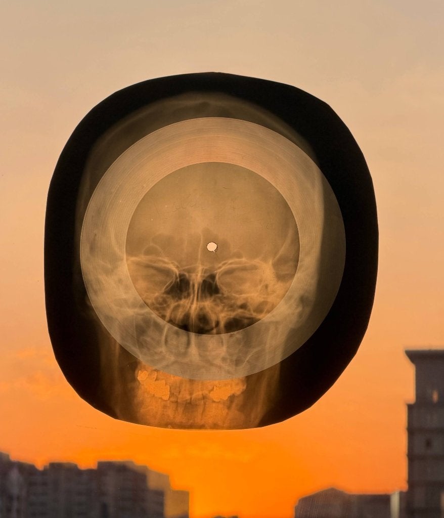 Soviet-era X-ray Record David Bowie - Life on Mars, Overige formaten, Ophalen of Verzenden, Speciale editie, Zo goed als nieuw