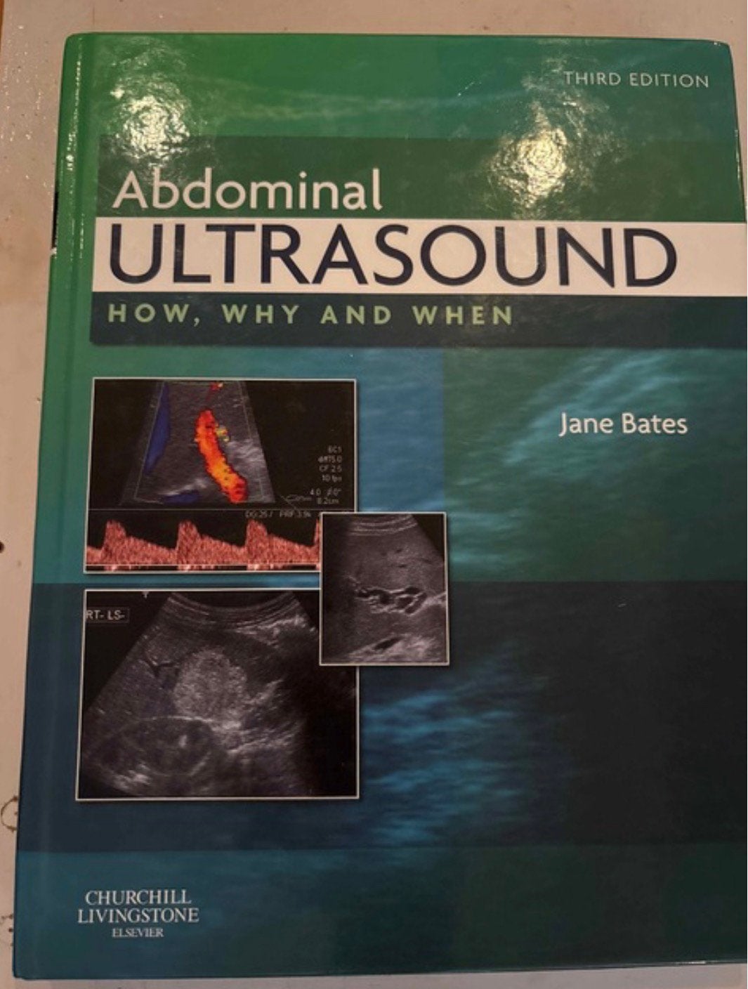 Abdominal ultrasound, Ophalen of Verzenden, Zo goed als nieuw, Medisch