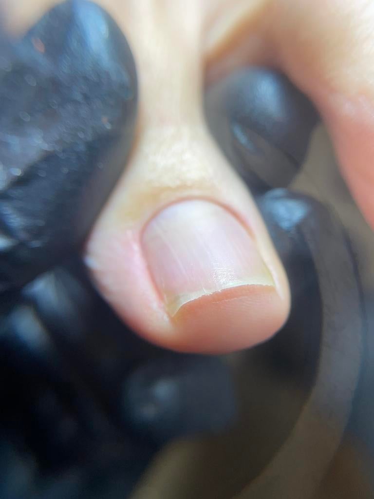 Pedicure Gespecialiseerd Haarlemmermeer/Bollenstreek, Ophalen of Verzenden, Zo goed als nieuw, Overige typen