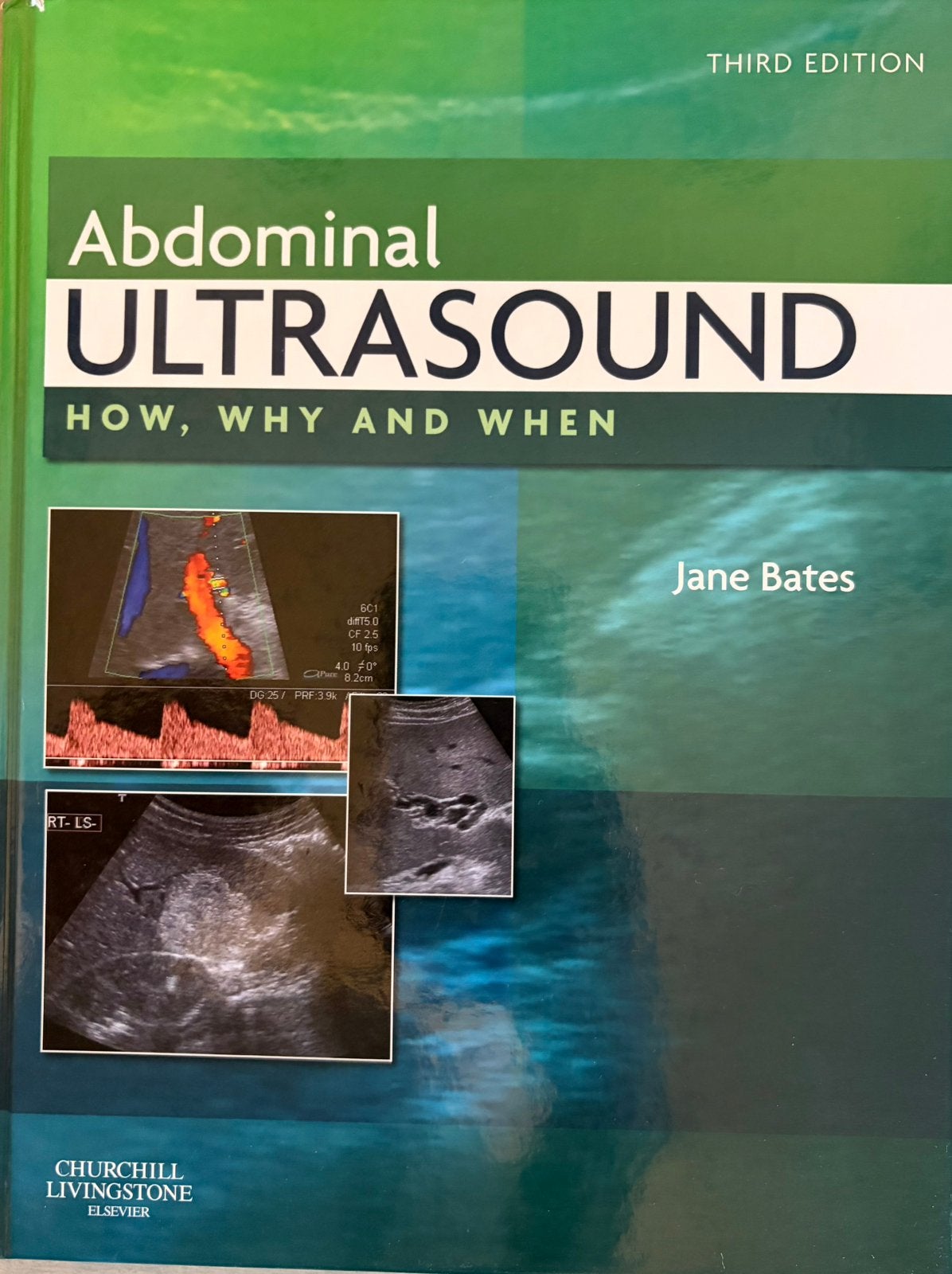 Abdominal ultrasound, Boeken, Ophalen of Verzenden, Beta, Zo goed als nieuw, HBO