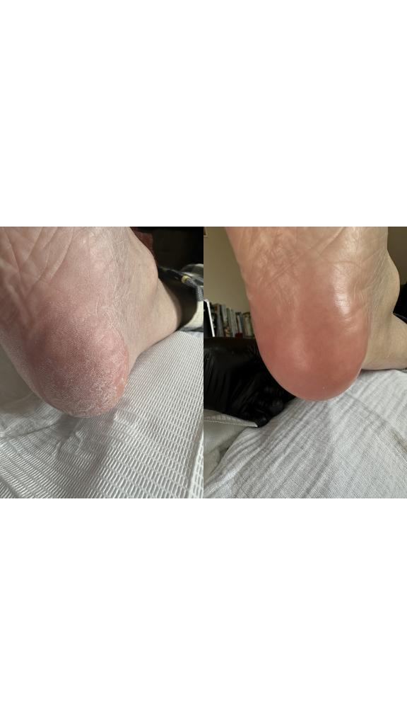 Pedicure aan huis in Tilburg en omstreken, Ophalen of Verzenden, Nieuw, Elektrische rolstoel