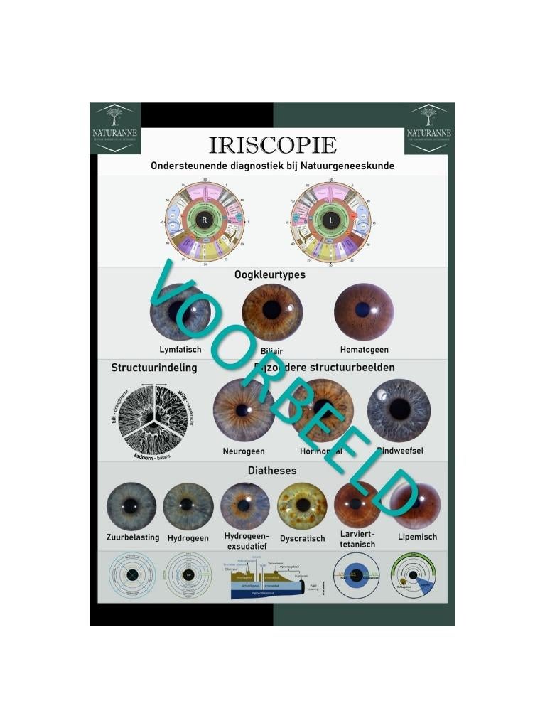 Poster iridology, Verzamelen, Rechthoekig Staand, Deurposter of groter, Nieuw, Ophalen of Verzenden