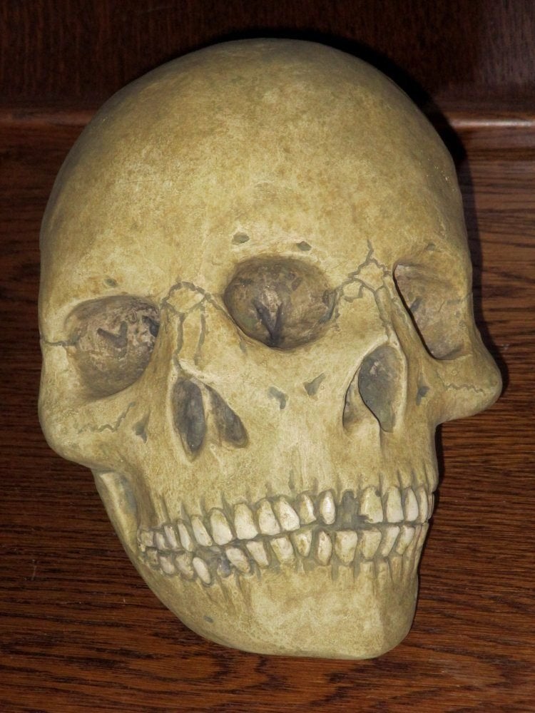 REPLICA vergroeide Siamese tweeling Schedel, freak skull, Ophalen of Verzenden