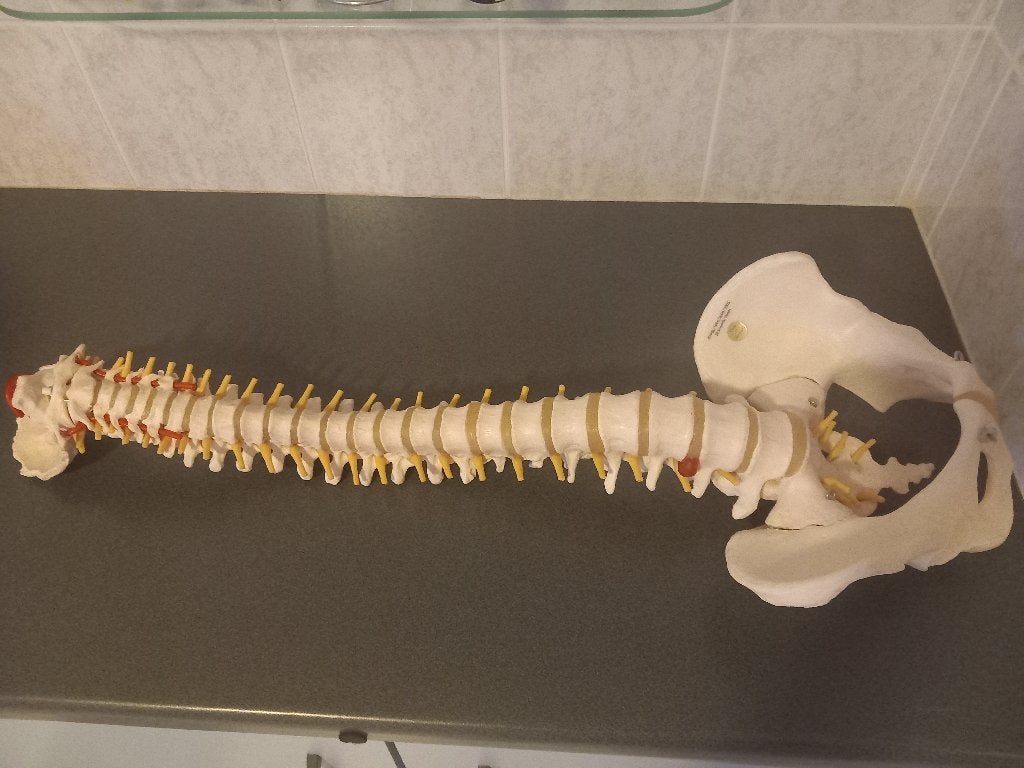 ruggegraat met Discus Hernia uitstulping, Verzenden, Nieuw, Meerdere media, Taal en Studie