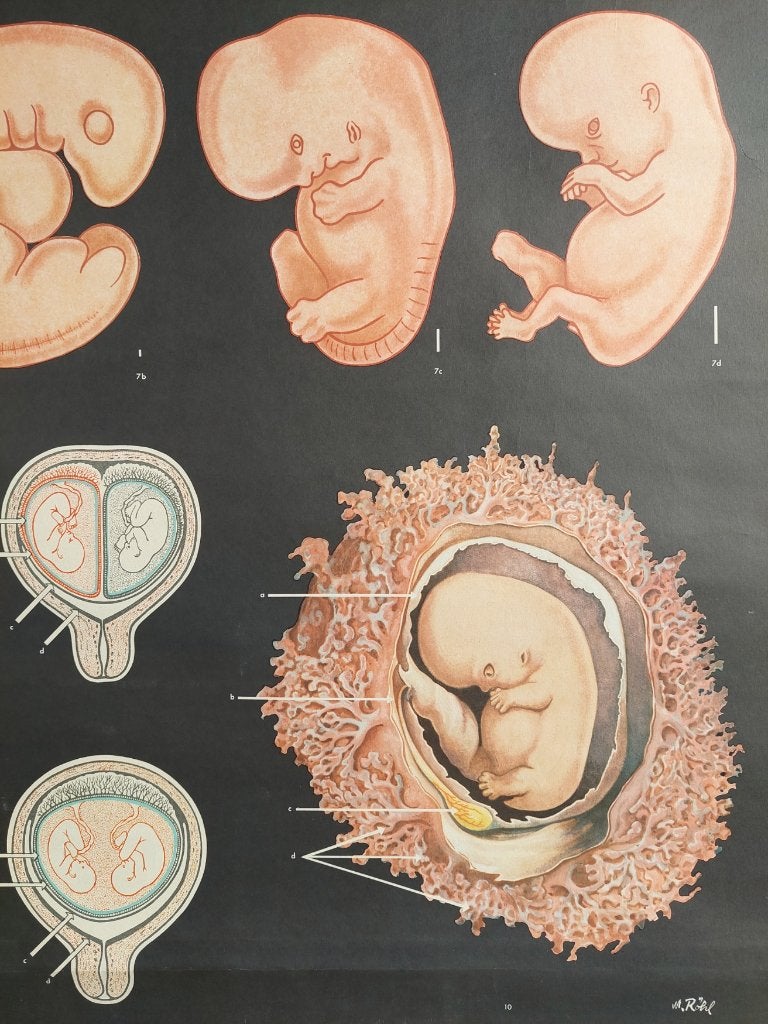 Medische schoolplaat Embryo, Ophalen of Verzenden, Natuur en Biologie