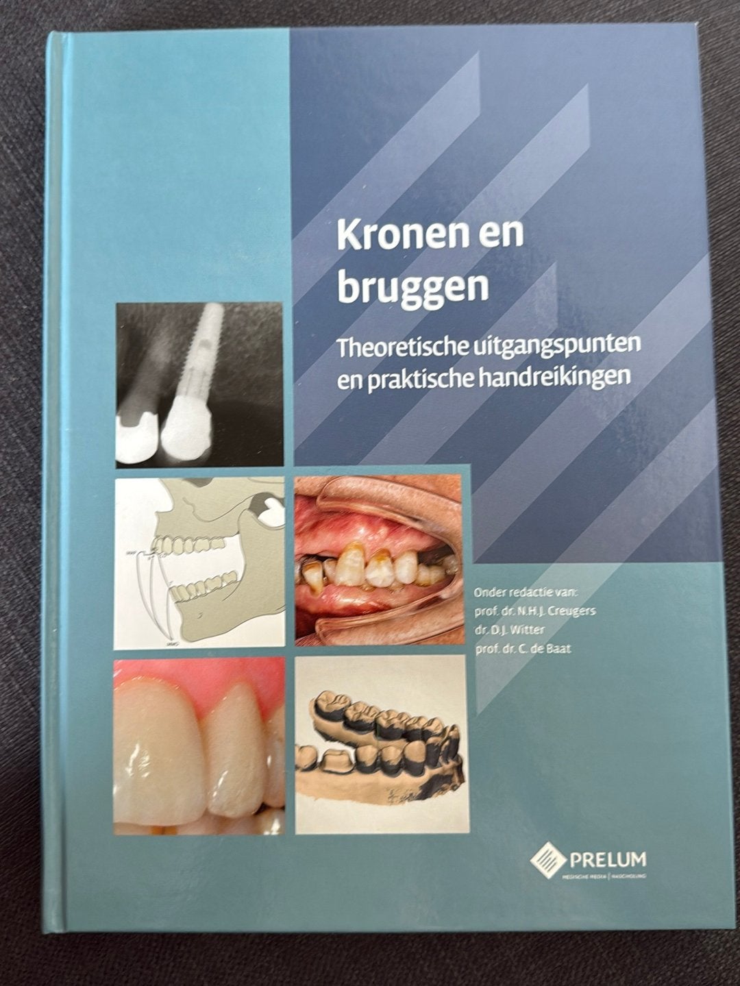 Kronen en bruggen, Boeken, Ophalen of Verzenden, Zo goed als nieuw, Natuurwetenschap