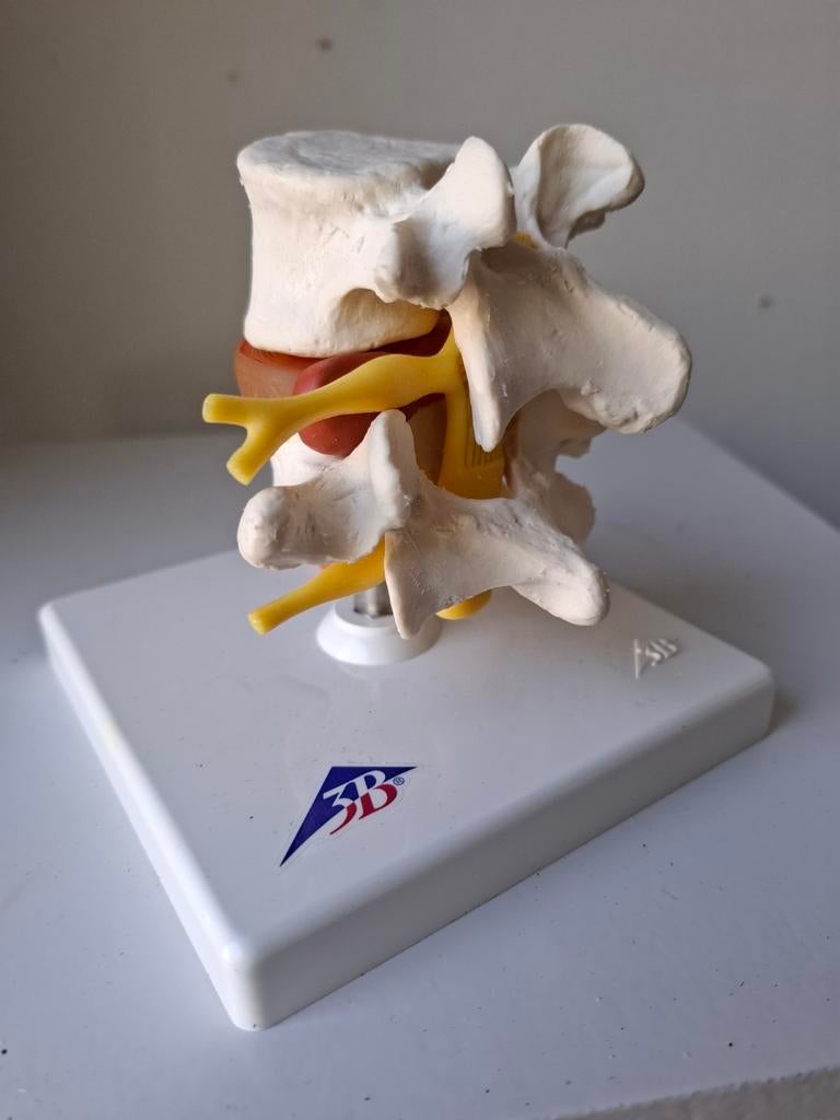Vintage anatomisch model medisch, Antiek en Kunst, Ophalen of Verzenden