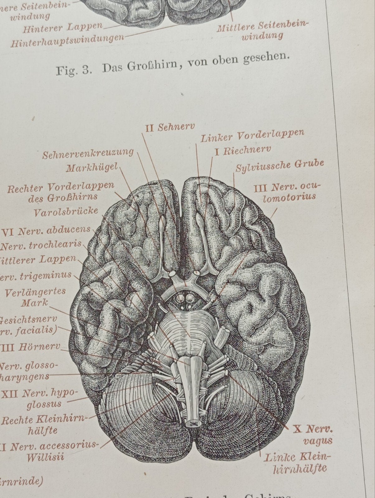 Anatomische Medische Gravure Gehoor & Hersenen 1895, Ophalen of Verzenden