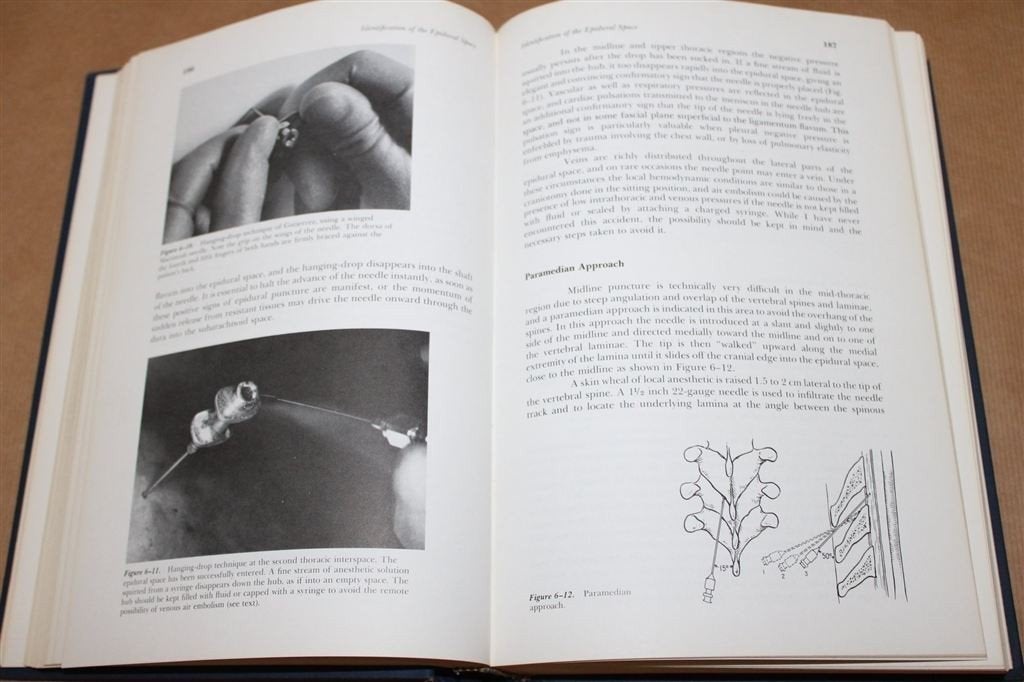 Epidural analgesia. Bromage., Ophalen of Verzenden, Gelezen