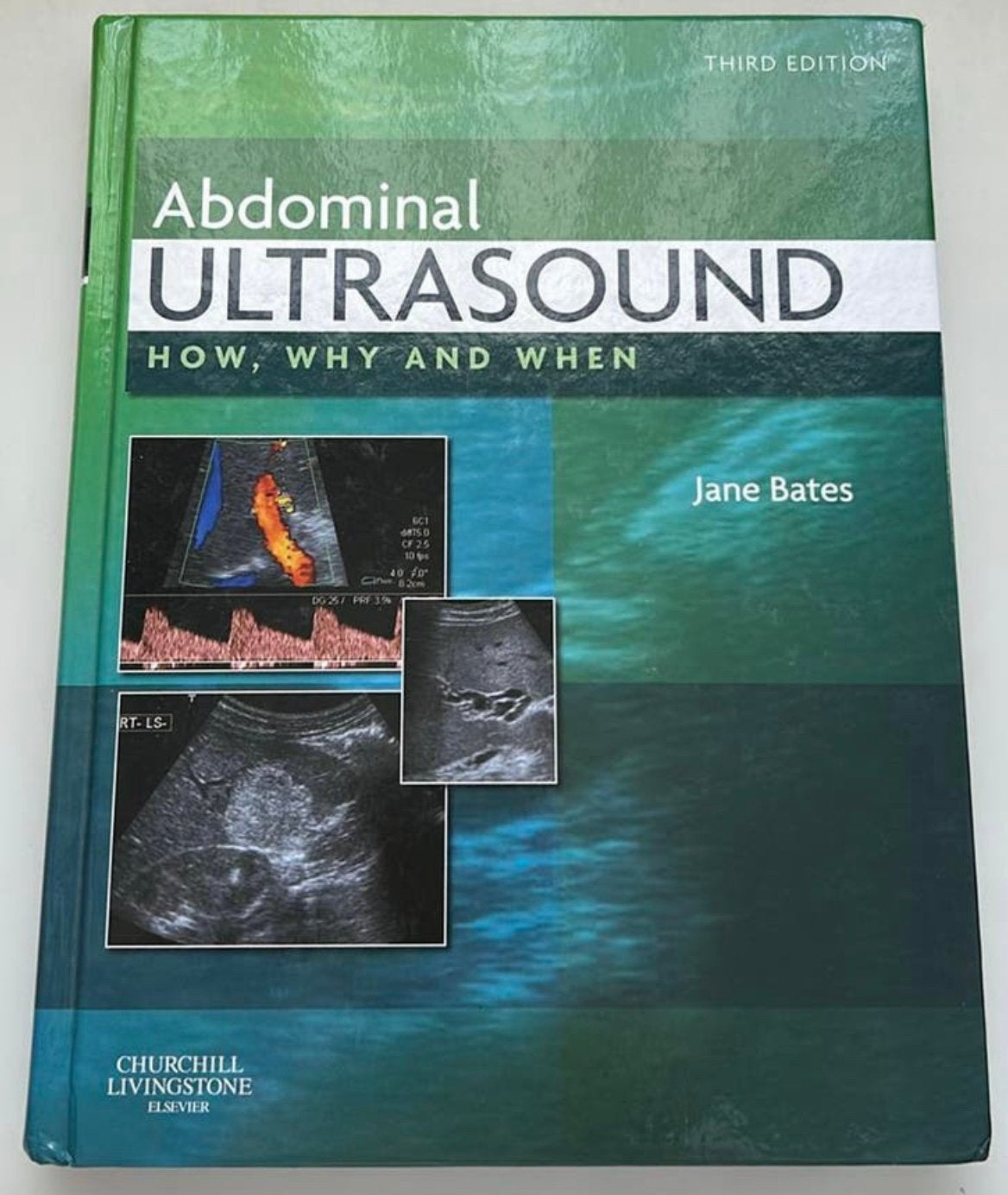 Abdominal ultrasound - how, why and when, Boeken, Ophalen of Verzenden, Beta, Zo goed als nieuw, WO