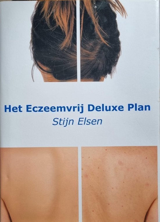Het Eczeemvrij Totaal Plan, Boeken, Ophalen of Verzenden