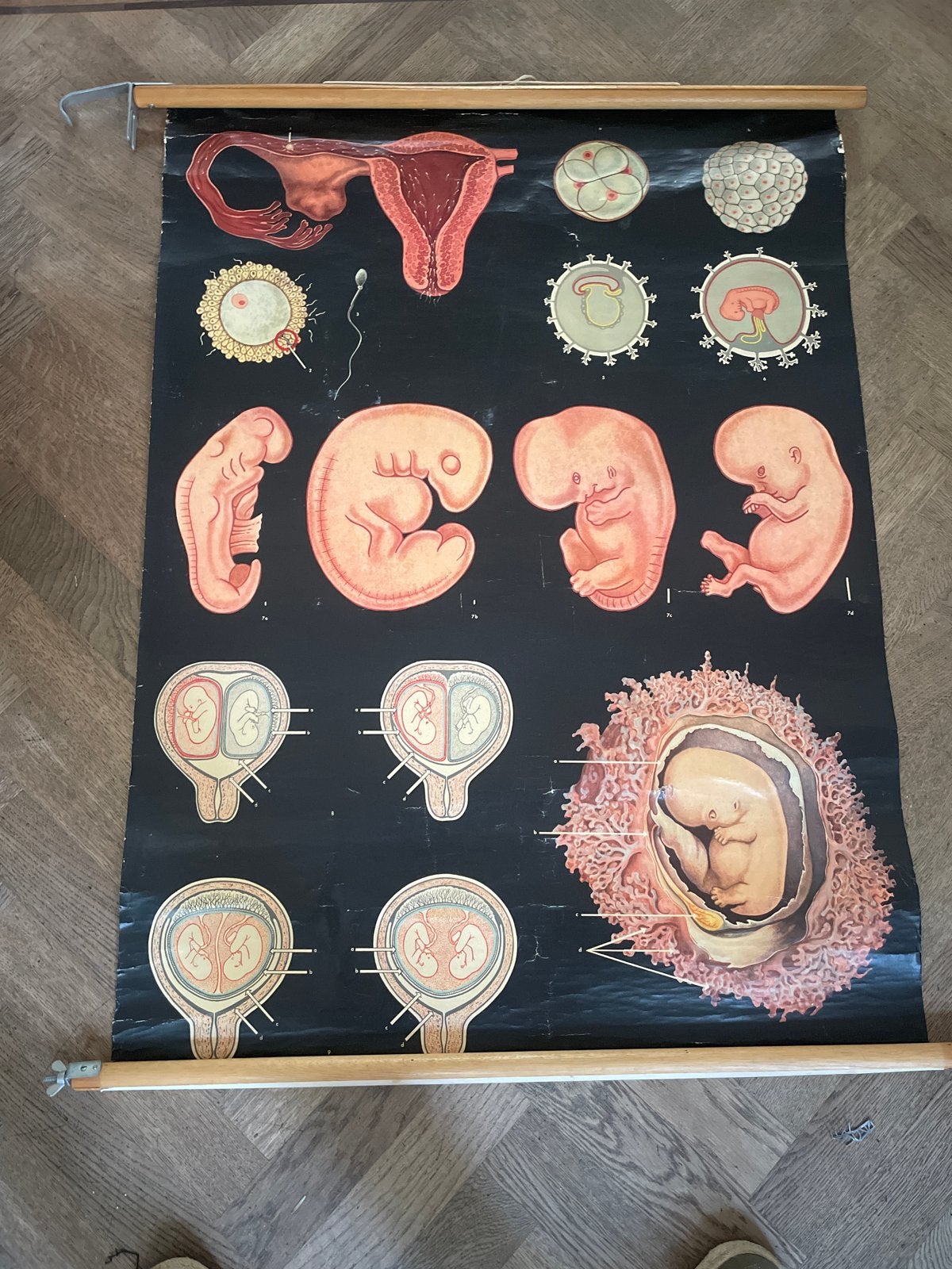 Vintage Anatomische Wandkaart: Menselijke Ontwikkeling, Ophalen, Zo goed als nieuw, Natuurwetenschap