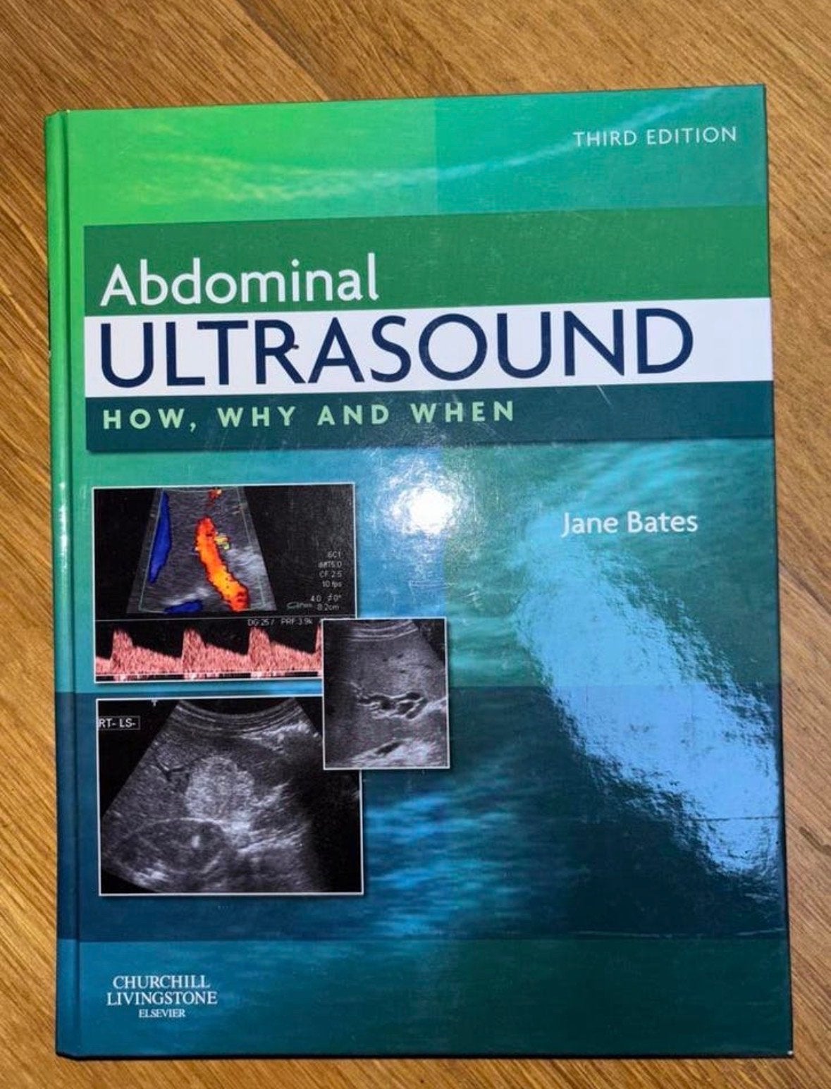Abdominale Echografie: Hoe, Waarom en Wanneer - Jane Bates, Ophalen of Verzenden, Beta, Zo goed als nieuw, HBO