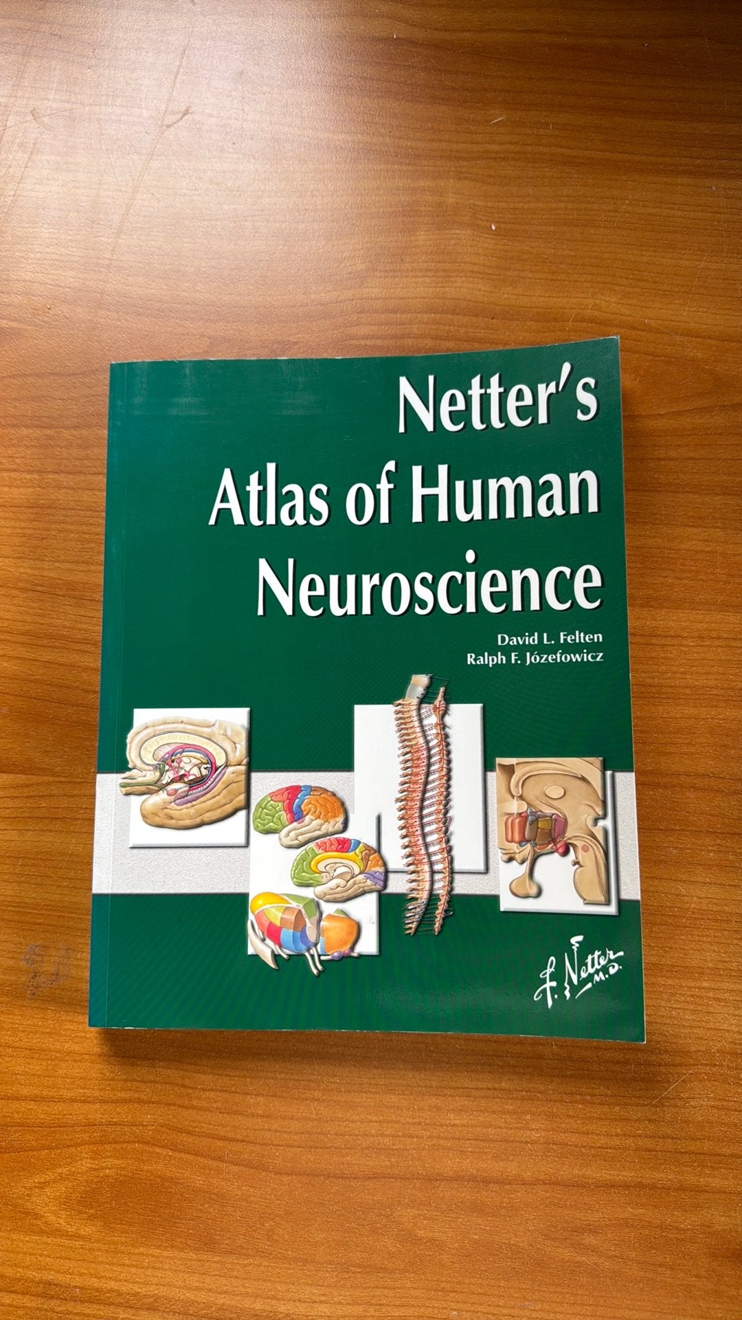 Netter's Atlas of Human Neuroscience, Boeken, Ophalen of Verzenden, Beta, Zo goed als nieuw, HBO
