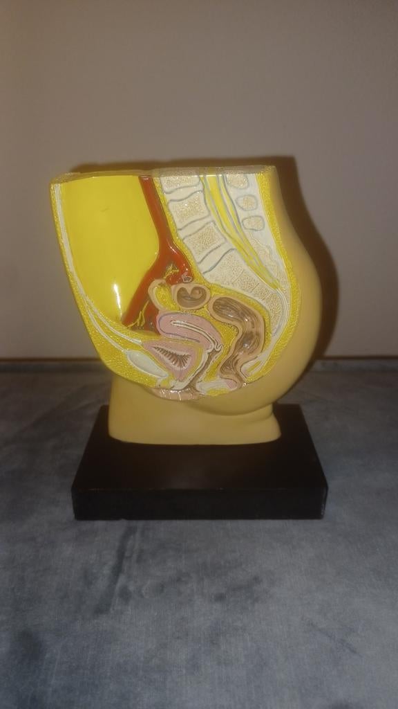Anatomisch model doorsnede vrouw bekken op stand, Antiek en Kunst, Ophalen of Verzenden