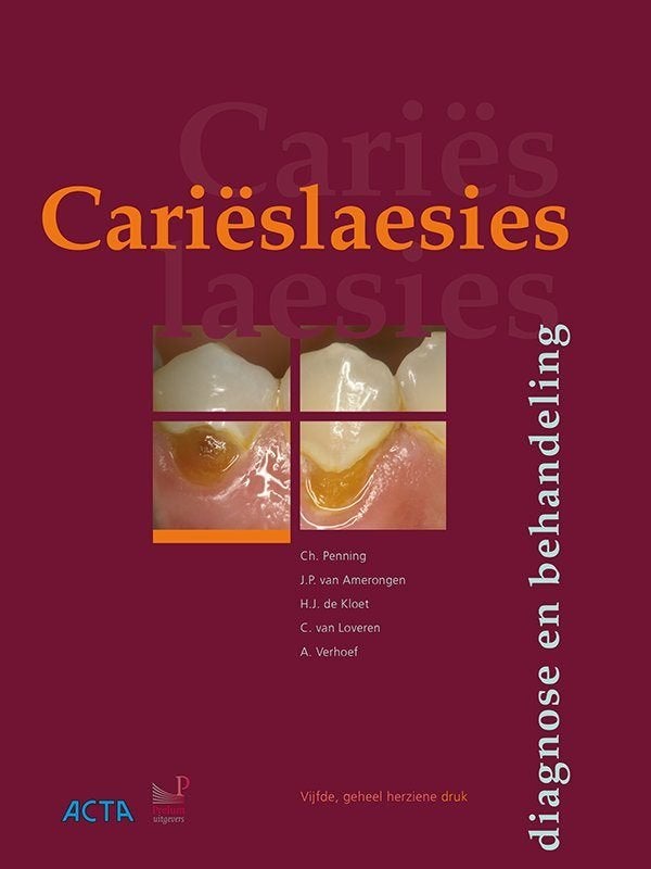 Cariëslaesies, Ophalen of Verzenden, Beta, Zo goed als nieuw, HBO