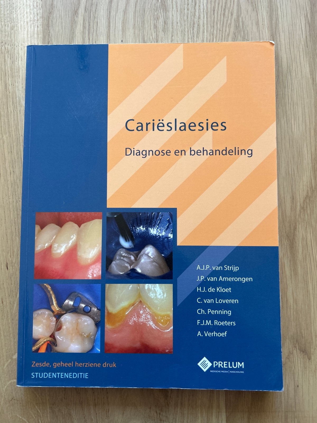 Cariëslaesies: Diagnose en behandeling (Studenteneditie), Boeken, Studieboeken en Cursussen, Zo goed als nieuw, WO, Beta, Ophalen of Verzenden