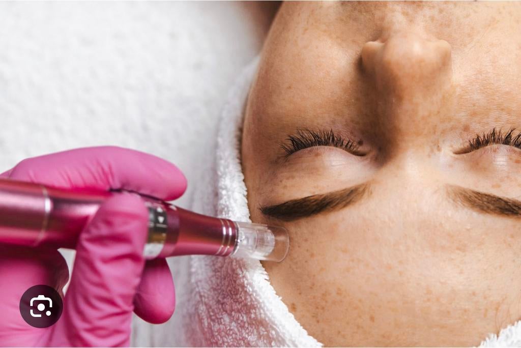 Dermapen microneedling, Ophalen of Verzenden, Zo goed als nieuw, Gehele gezicht