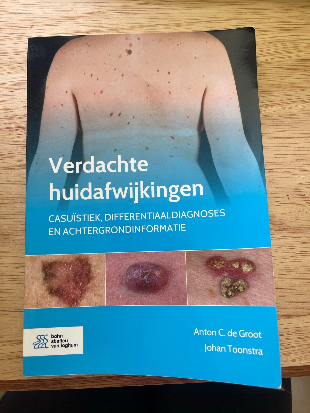 Verdachte huidafwijkingen: Casuïstiek, Differentiaaldiagnose, Ophalen of Verzenden, Beta, Zo goed als nieuw, WO