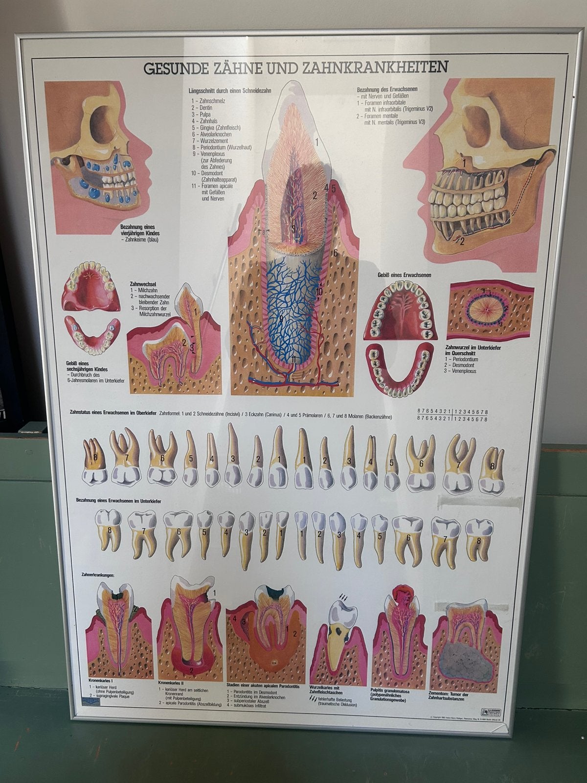 Tandheelkunde kaakchirurgie anatomie vintage poster Rüdiger, Antiek en Kunst, Ophalen of Verzenden, Natuur en Biologie