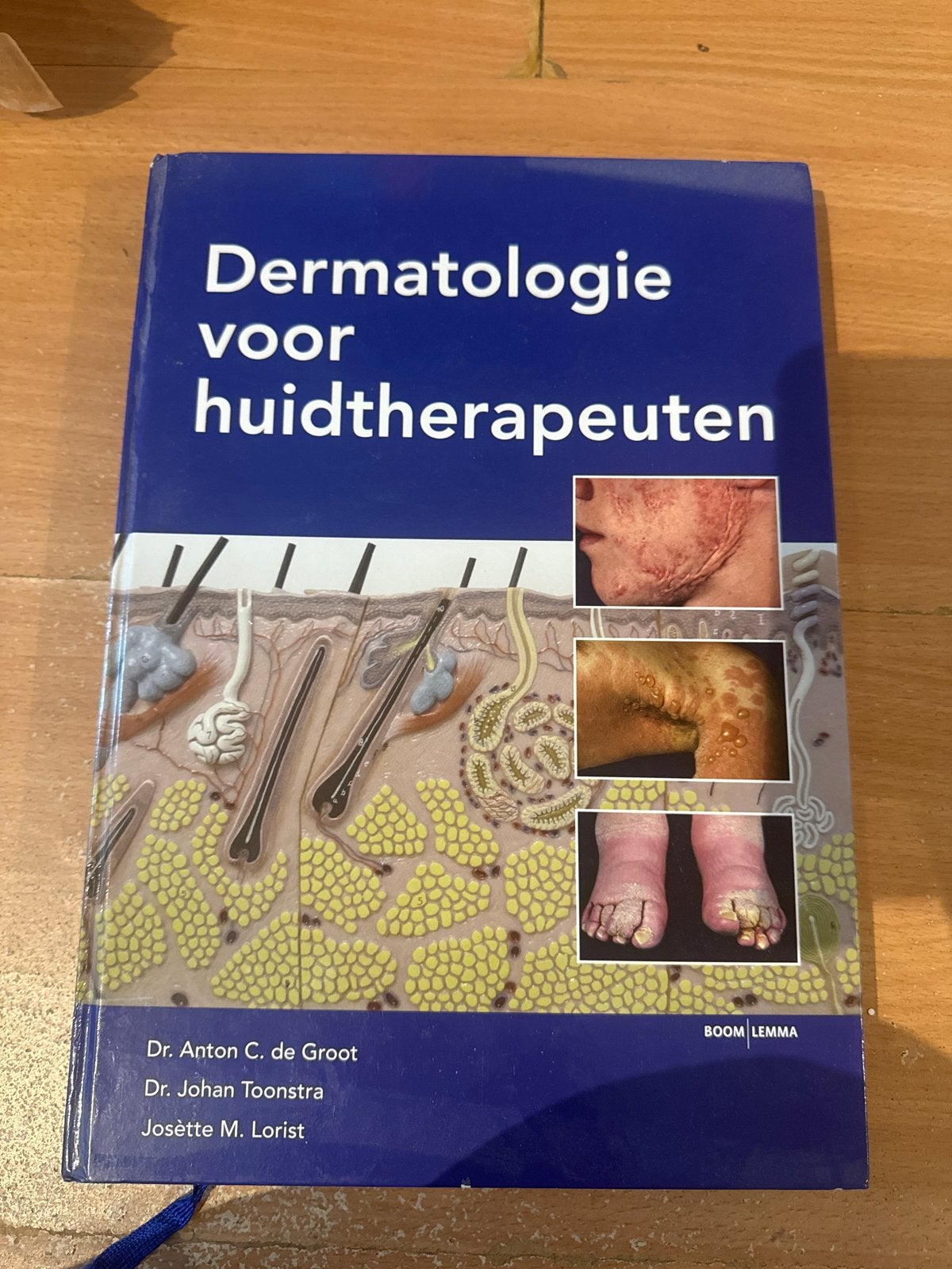 Dermatologie voor huidtherapeuten - Gebruikt studieboek, Ophalen of Verzenden, Gelezen, HBO