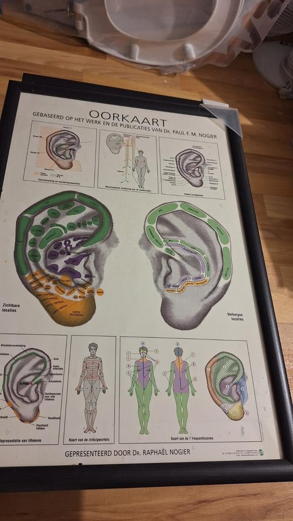 Acupuntuur schilderijen, posters in lijst., Ophalen, A1 t/m A3