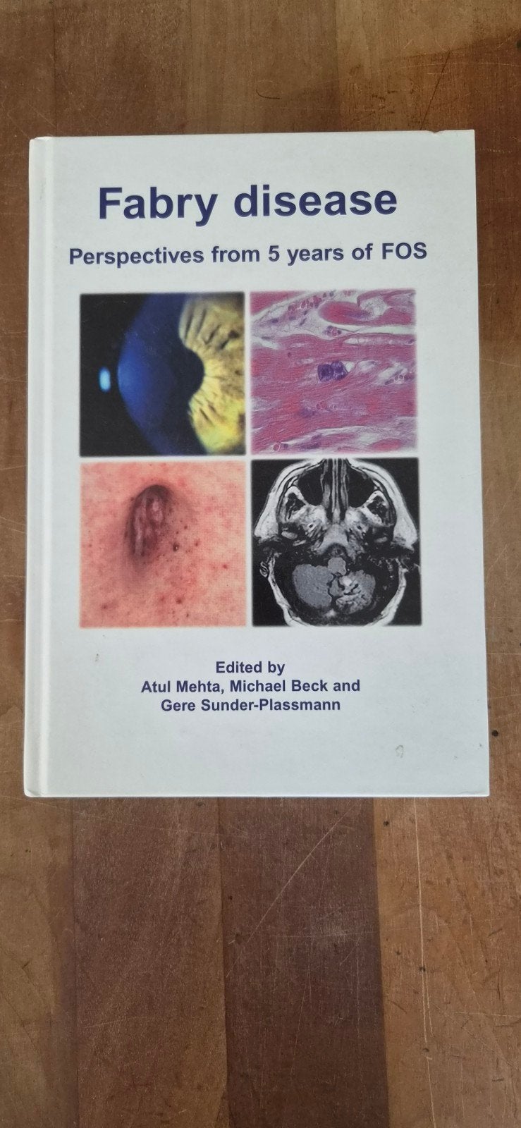 Fabry ziekte: Perspectieven na 5 jaar FOS, Ophalen of Verzenden, Atul Mehta, Michael Beck en Gere Sunder-Plassmann, Beta, WO